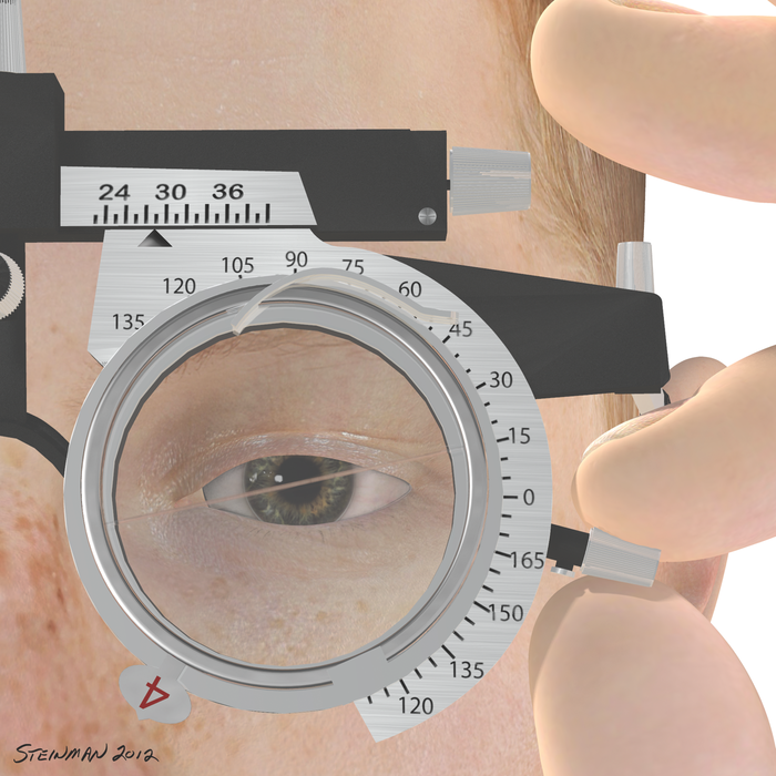 14-02B Double 4 diopter pris to measure cyclophoria
