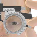 14-02B Double 4 diopter pris to measure cyclophoria